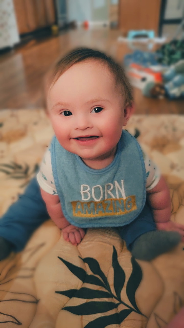 Matthew with Down syndrome smiling at 10 months old