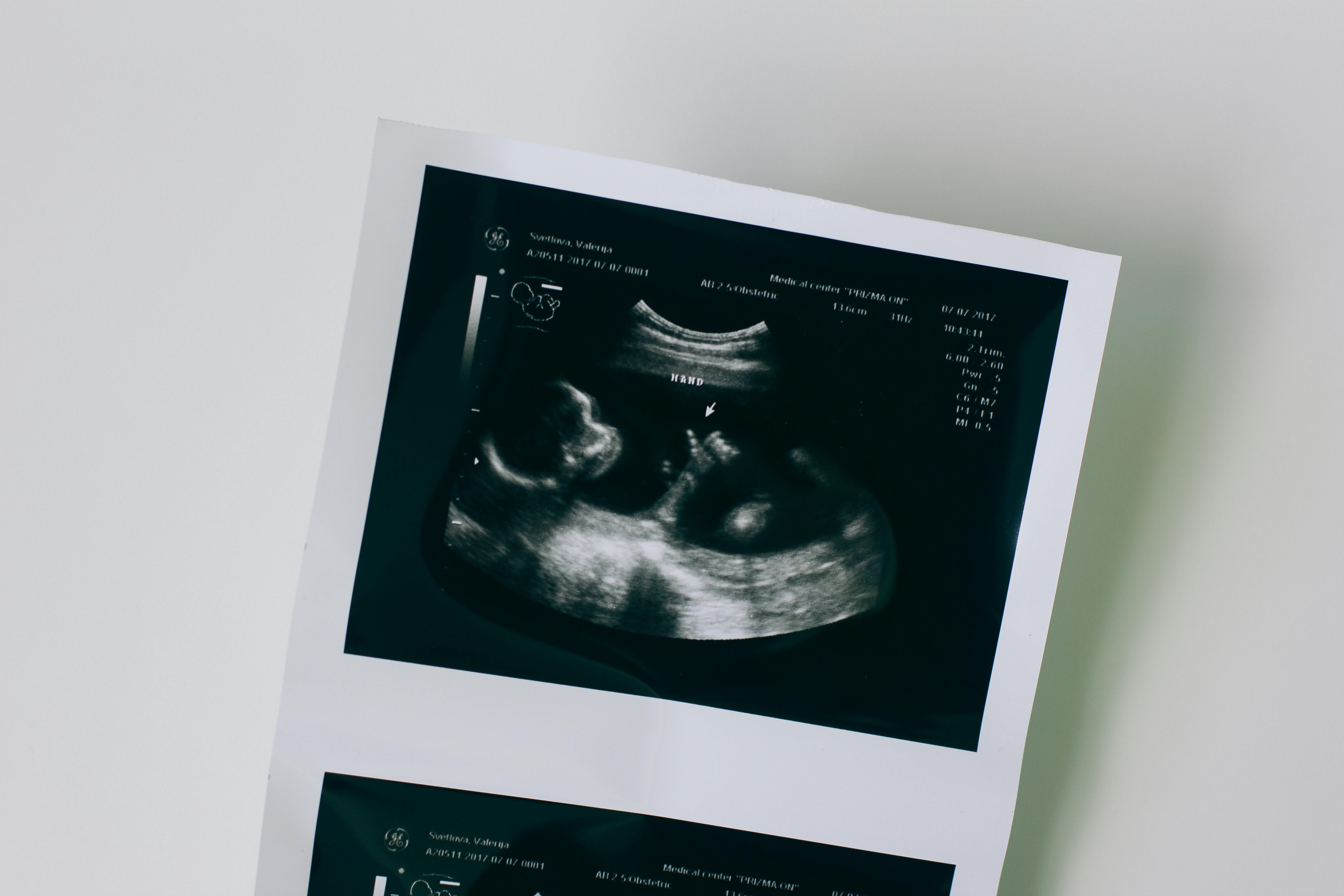 Abortion drugs now arrive as fast as an Amazon package