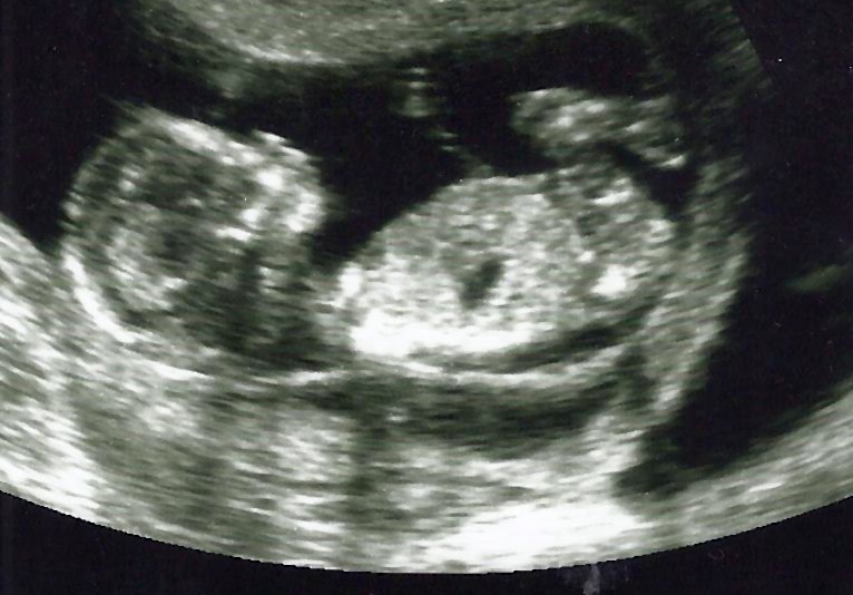 A Month for Life: Reflections from the U.S. Senate gallery on a historic moment for the unborn