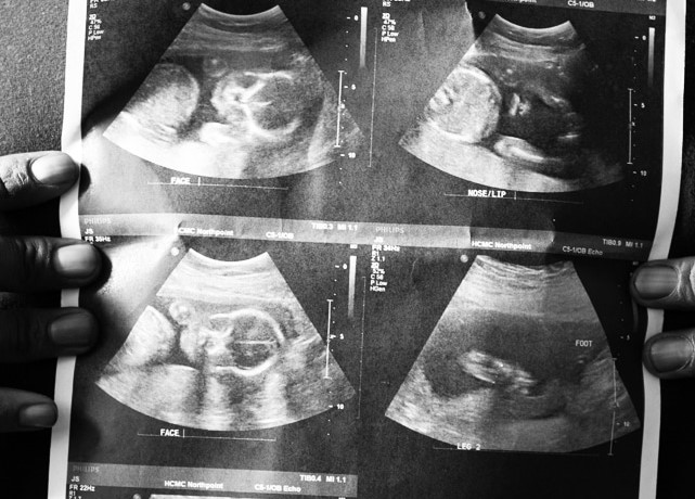 Prayerful pro-life ministry rescues babies from abortion in two states