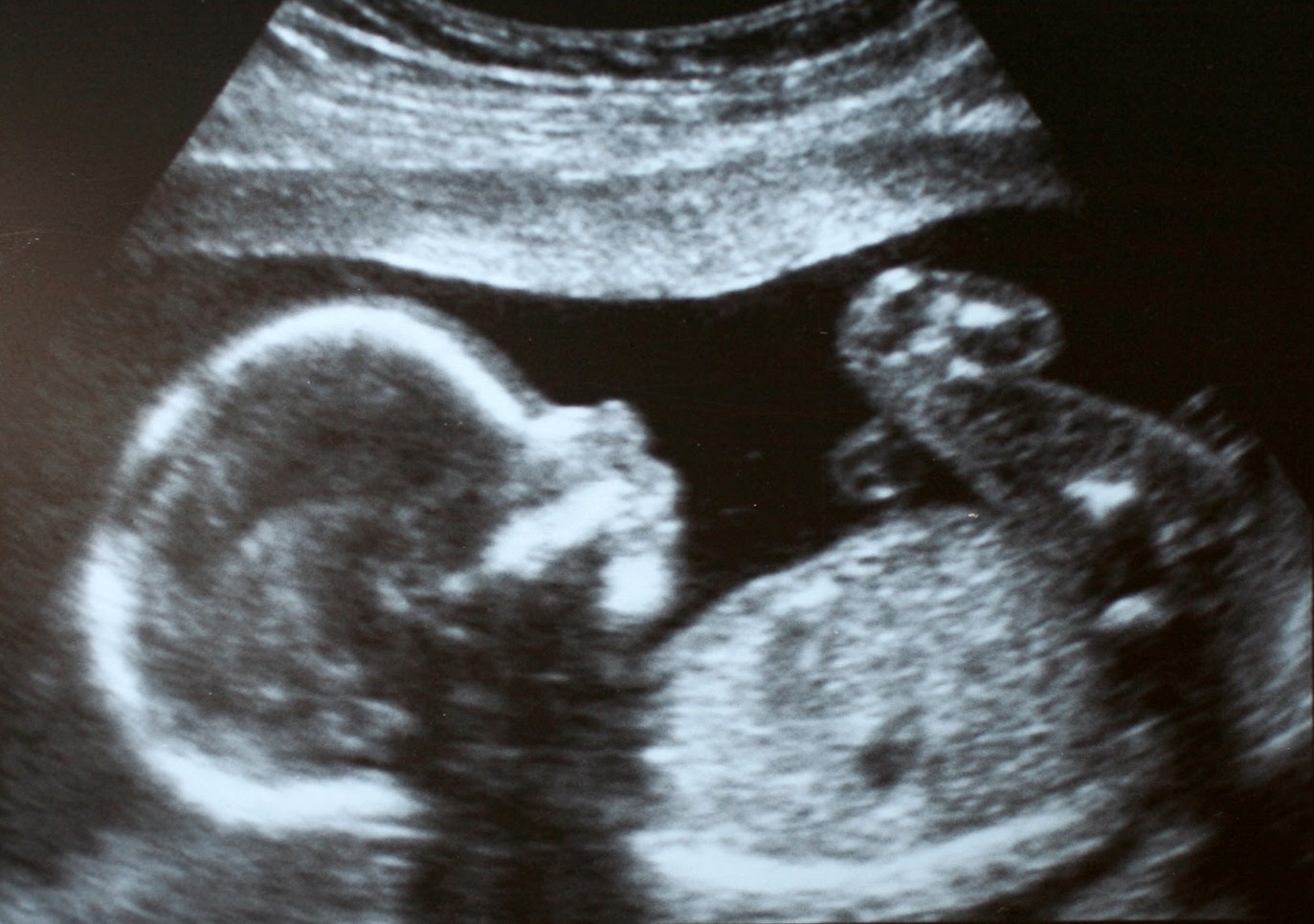 Wyoming governor signs 'heartbeat bill' protecting preborn children