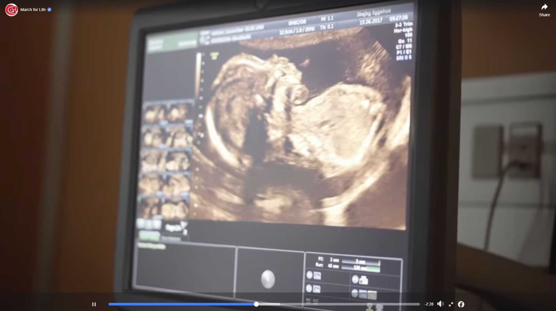 Woman walked out of her 35-week abortion and found help at a pregnancy center