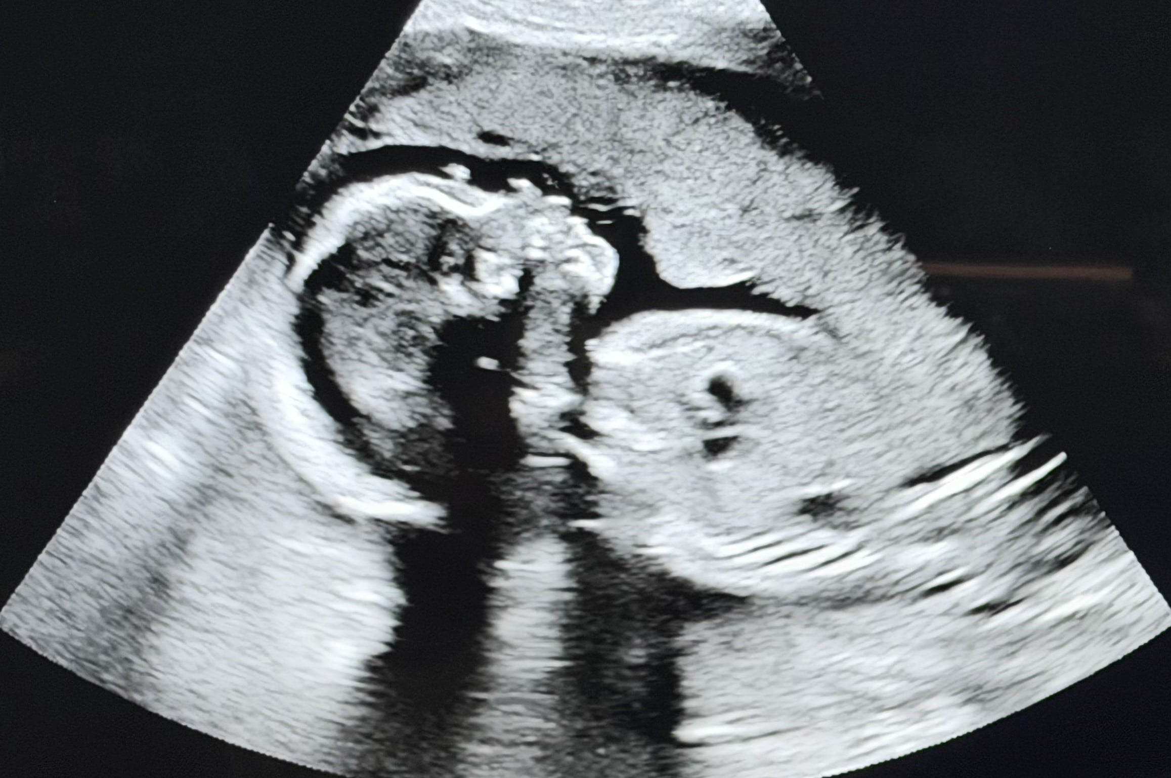 The People of the State of California v. Heartbeat International and RealOptions
