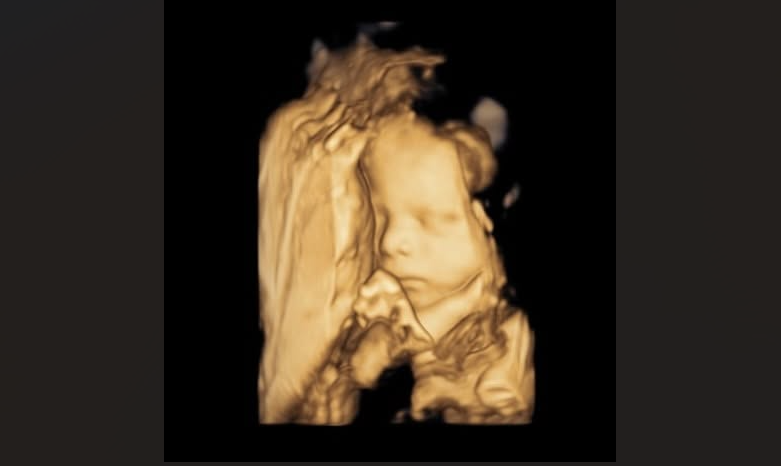 “Grateful for this pregnancy” – Mom’s story shows chemical abortion is not the easy fix proponents make it out to be