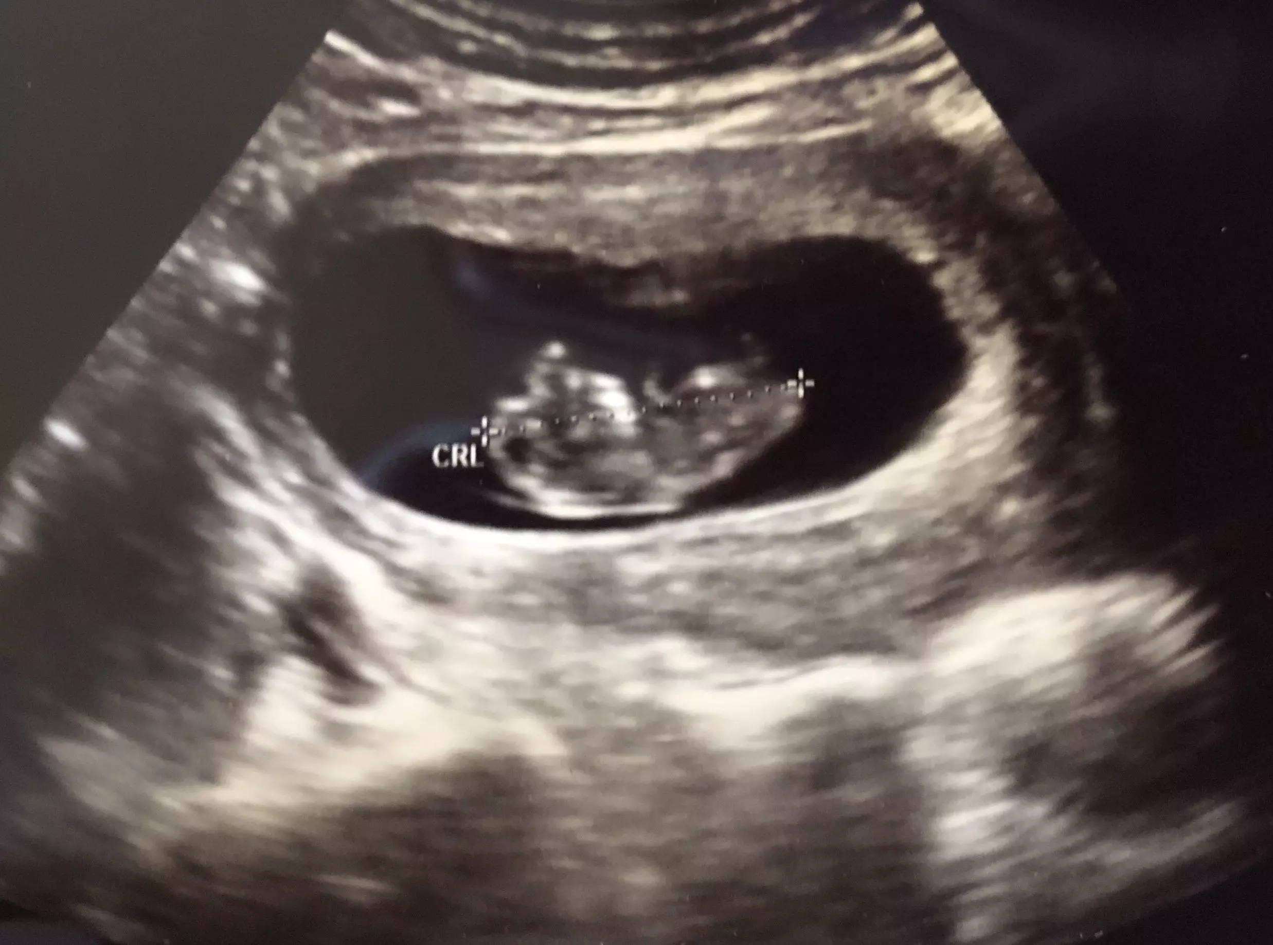 The “need” for and availability of abortion in post-Roe America