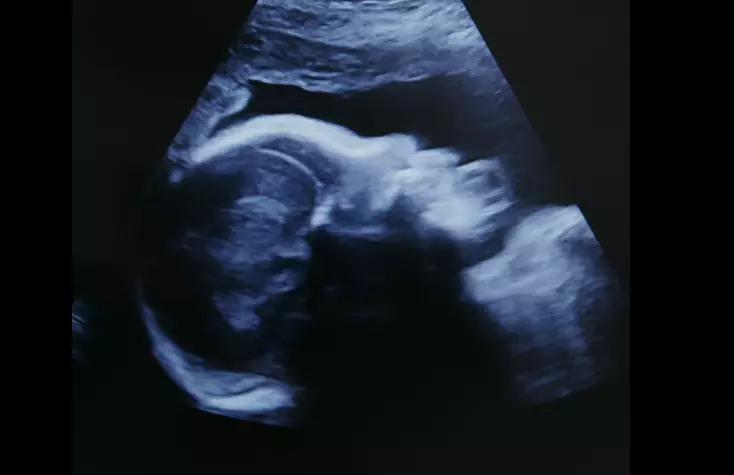 Biden’s State of the Union address to push abortion