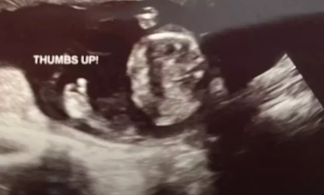 Unborn child’s gesture gives boost to center amid post-Roe abortion hostility