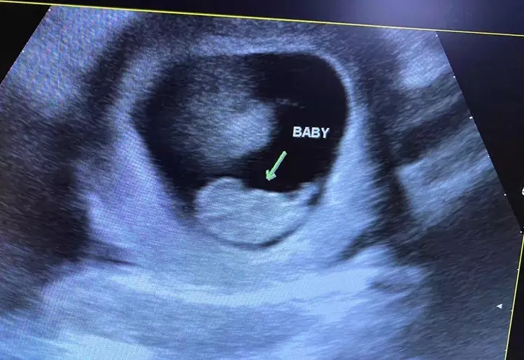 God’s making it happen; Miami center changes minds and hearts, saves lives