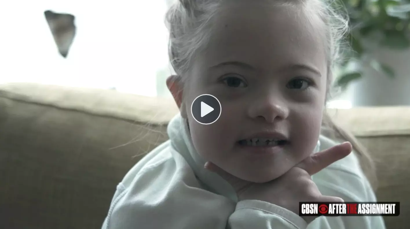 HEARTBEAT PRESIDENT: “Down syndrome is not a death sentence”