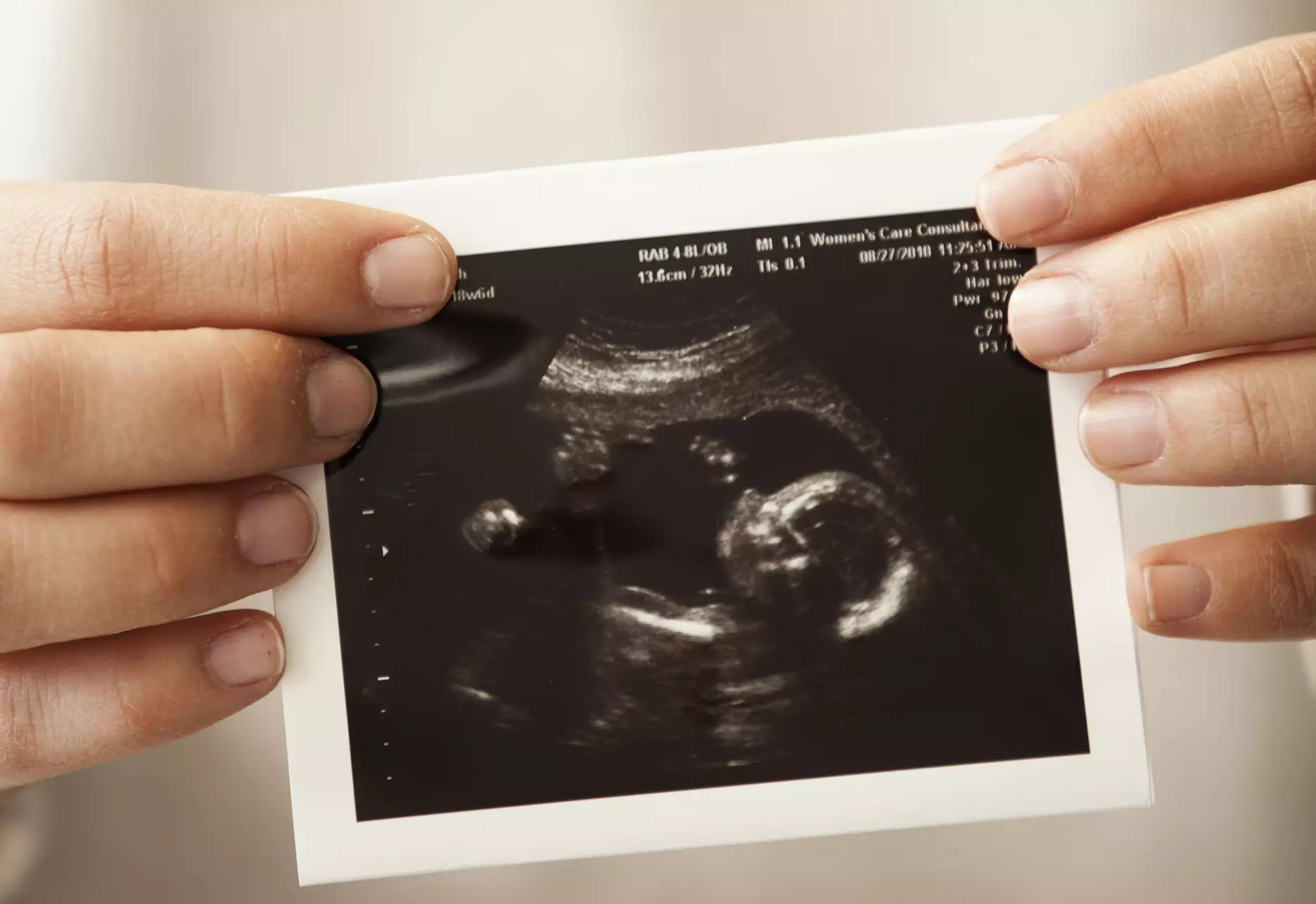 Planned Parenthood Report: 3 Percent of the Time, 100 Percent of Lives in the Womb are Lost