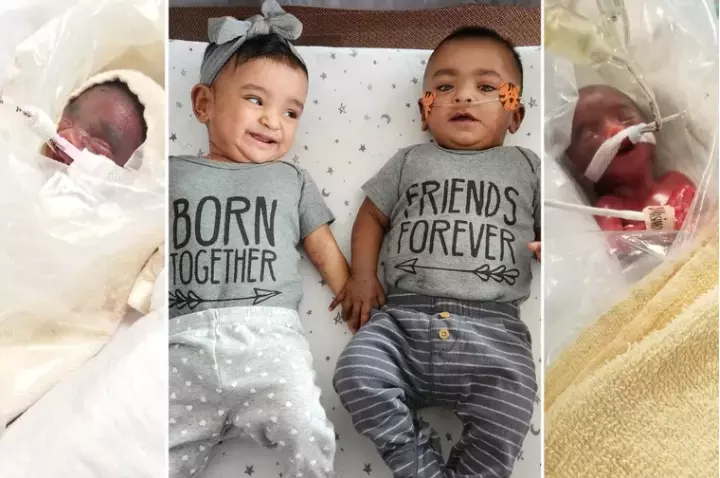 Guinness record holders: Smallest miracle twins born 4 months early defy all odds