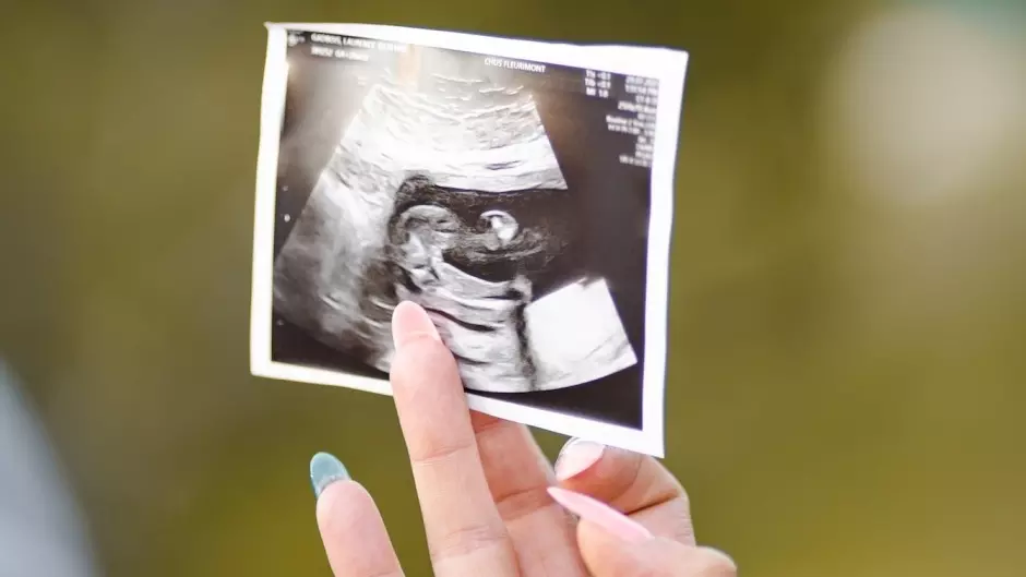 Austria: 73% say women are put under pressure to abort babies with disability