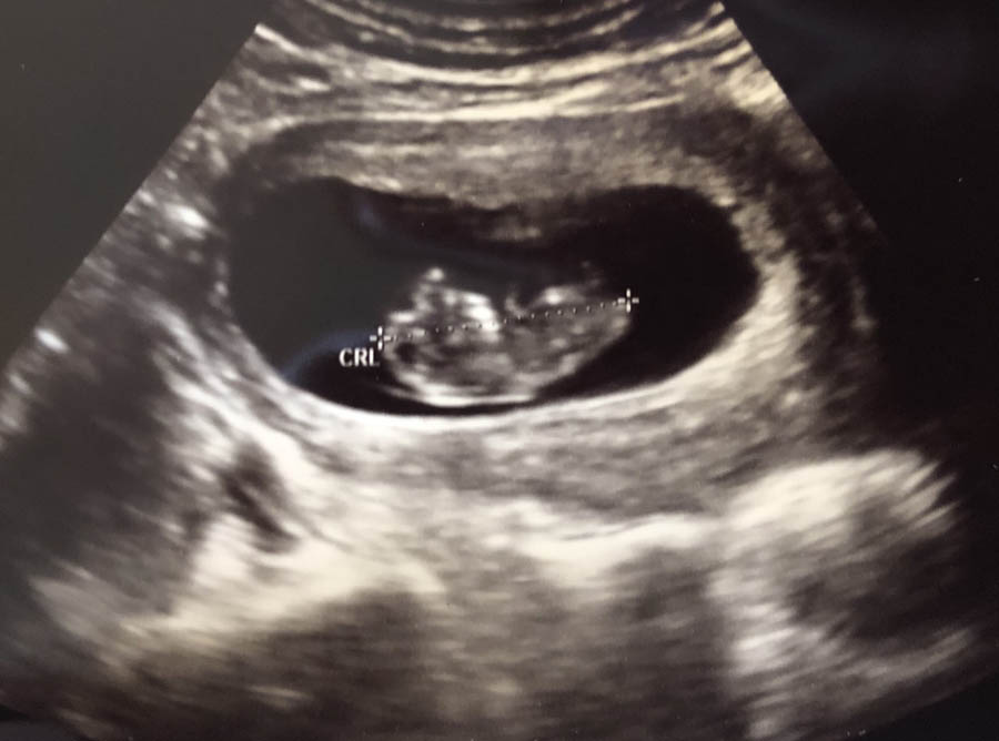 The “need” for and availability of abortion in post-Roe America