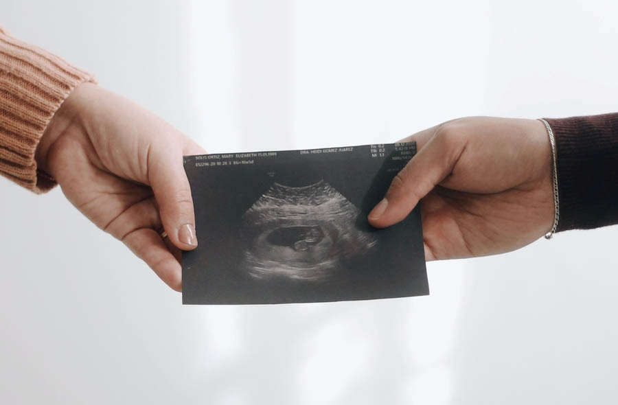 Fetal pain is real; while we're acknowledging that, let's acknowledge why