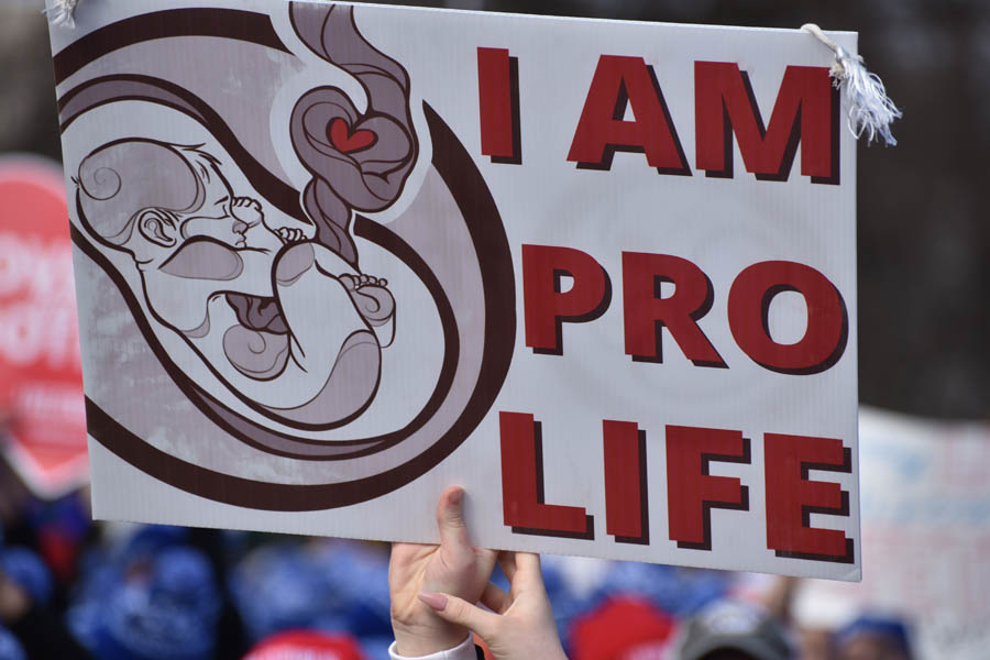 There is no fundamental right to abortion