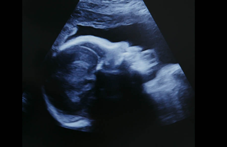 Biden’s State of the Union address to push abortion