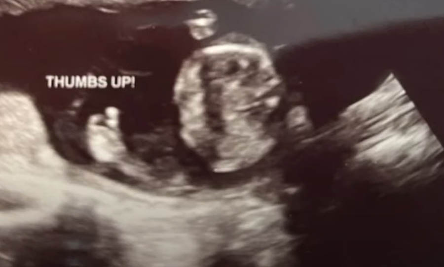 Unborn child’s gesture gives boost to center amid post-Roe abortion hostility