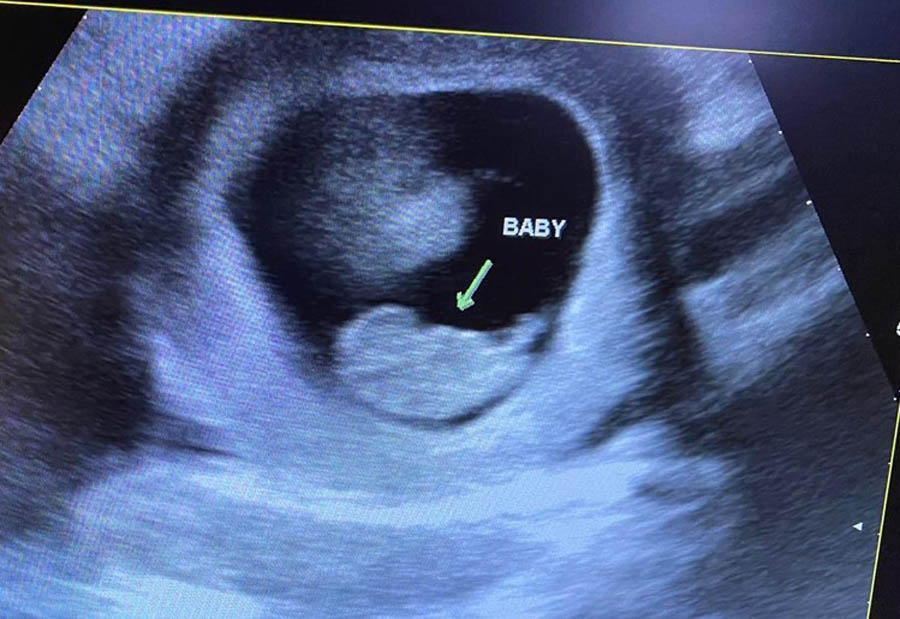 God’s making it happen; Miami center changes minds and hearts, saves lives