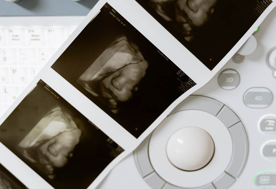 Responding to a common pro-choice tactic