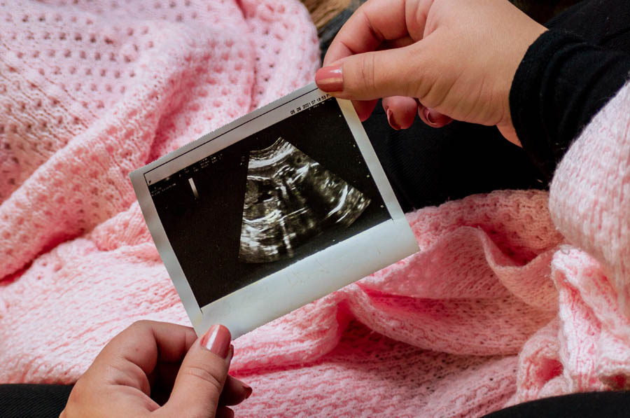 Federal Court instructs judge to dismiss lawsuit against Texas Heartbeat Act