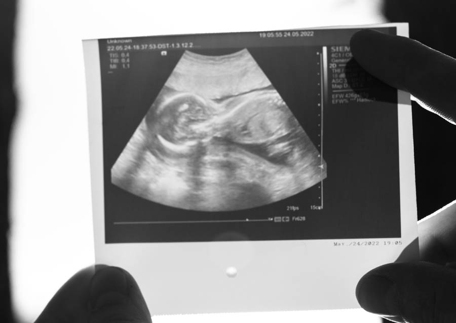 Creating new science to fit the Big Abortion agenda