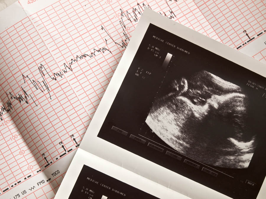 How We Save the Lives of the Unborn, One Question at a Time