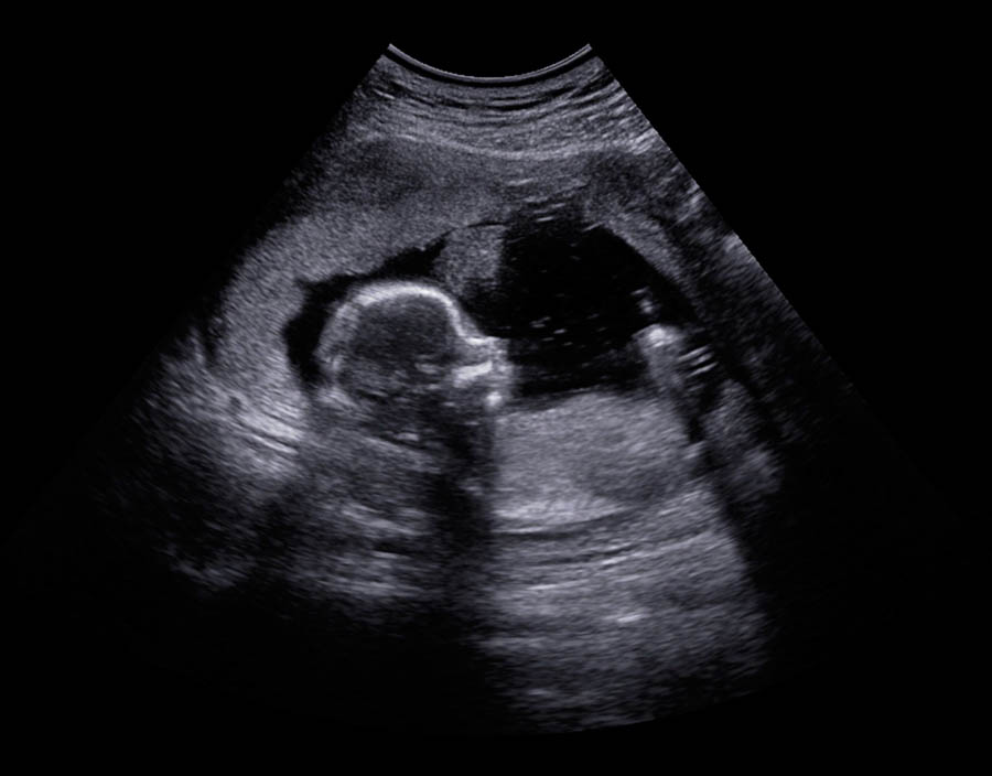 Abortionist ignores science in favor of pro-abortion propaganda